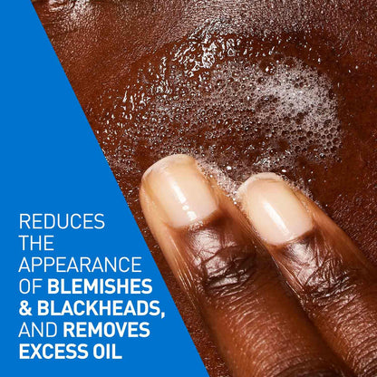 CeraVe Blemish Control Cleanser with 2% Salicylic Acid & Niacinamide - 236 ml