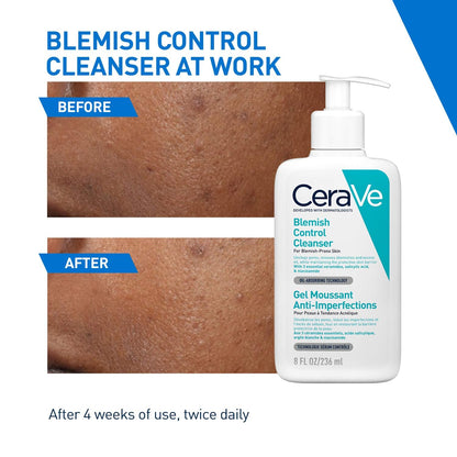 CeraVe Blemish Control Cleanser with 2% Salicylic Acid & Niacinamide - 236 ml