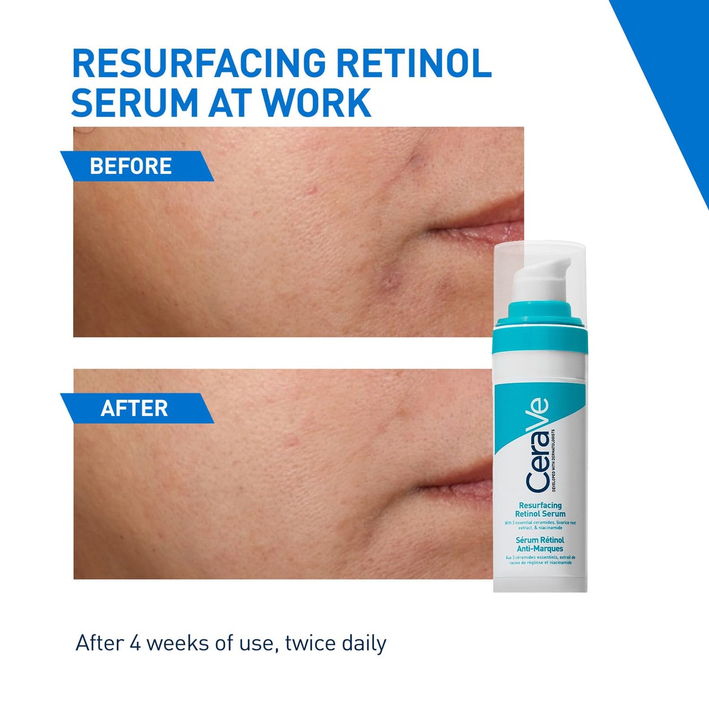 CeraVe Resurfacing Retinol Serum - 30ml