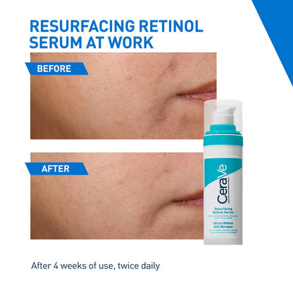CeraVe Resurfacing Retinol Serum - 30ml